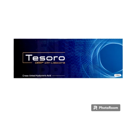 Tesoro Deep with Lidocaine